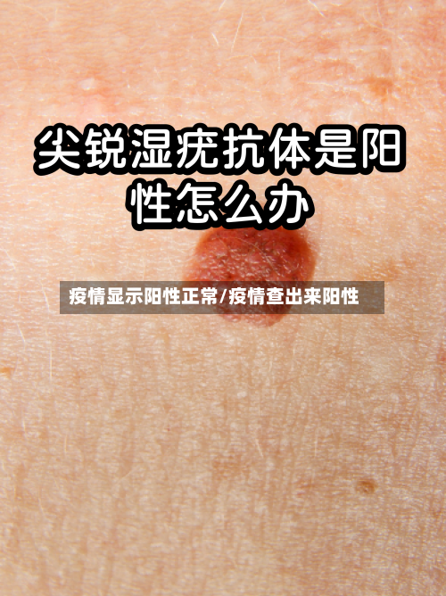 疫情显示阳性正常/疫情查出来阳性