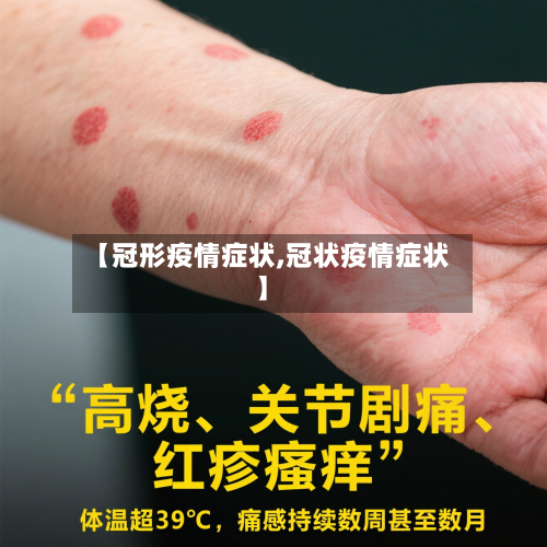 【冠形疫情症状,冠状疫情症状】-第2张图片